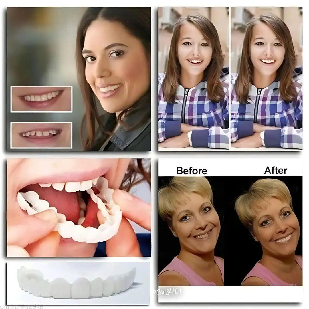 Advanced Cosmetic Teeth Denture (BUY 1 GET 1 FREE)