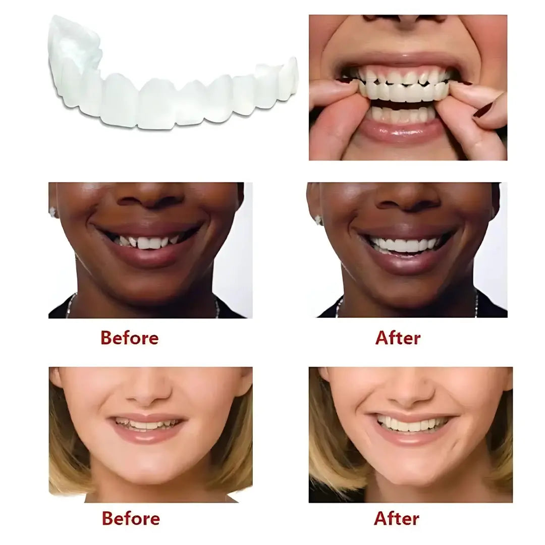 Advanced Cosmetic Teeth Denture (BUY 1 GET 1 FREE)