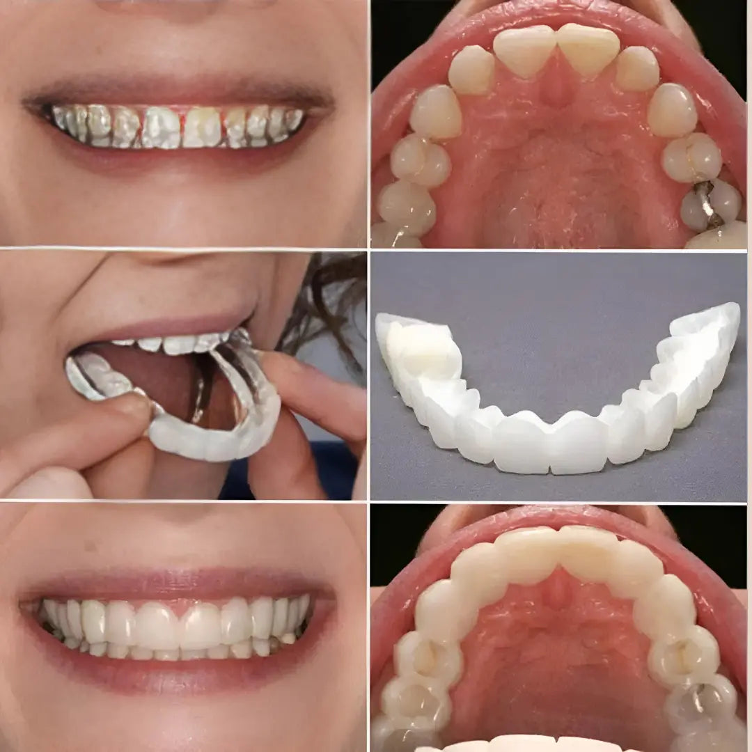 Advanced Cosmetic Teeth Denture (BUY 1 GET 1 FREE)