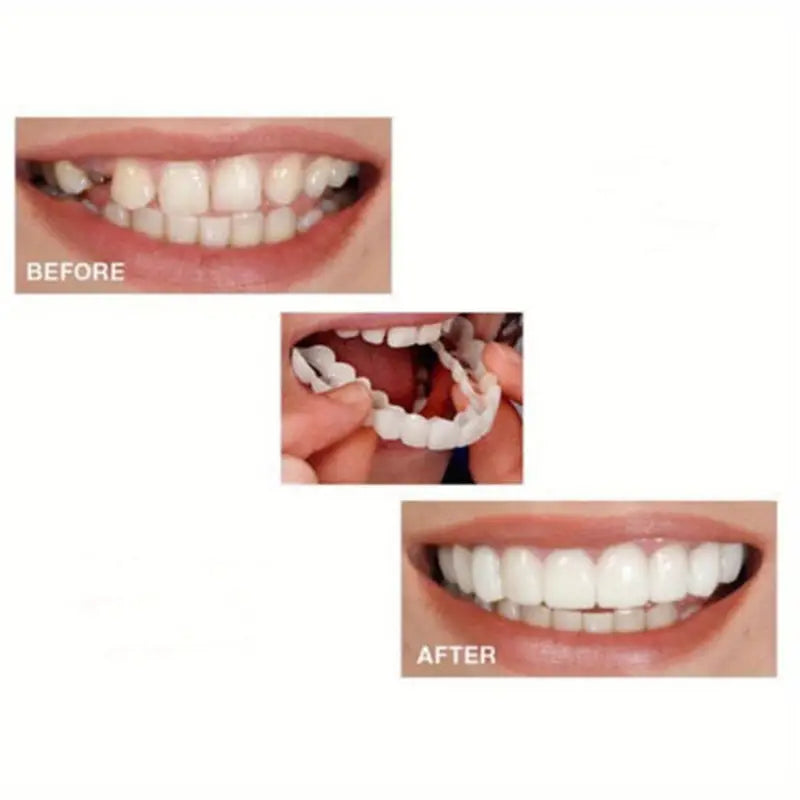 Advanced Cosmetic Teeth Denture (BUY 1 GET 1 FREE)