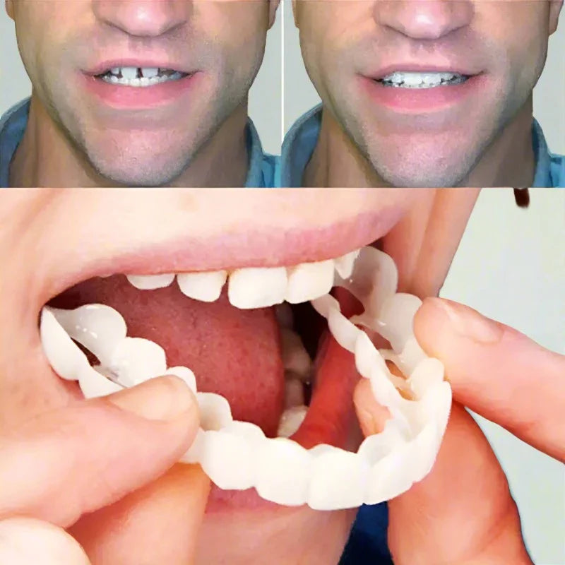 Advanced Cosmetic Teeth Denture (BUY 1 GET 1 FREE)