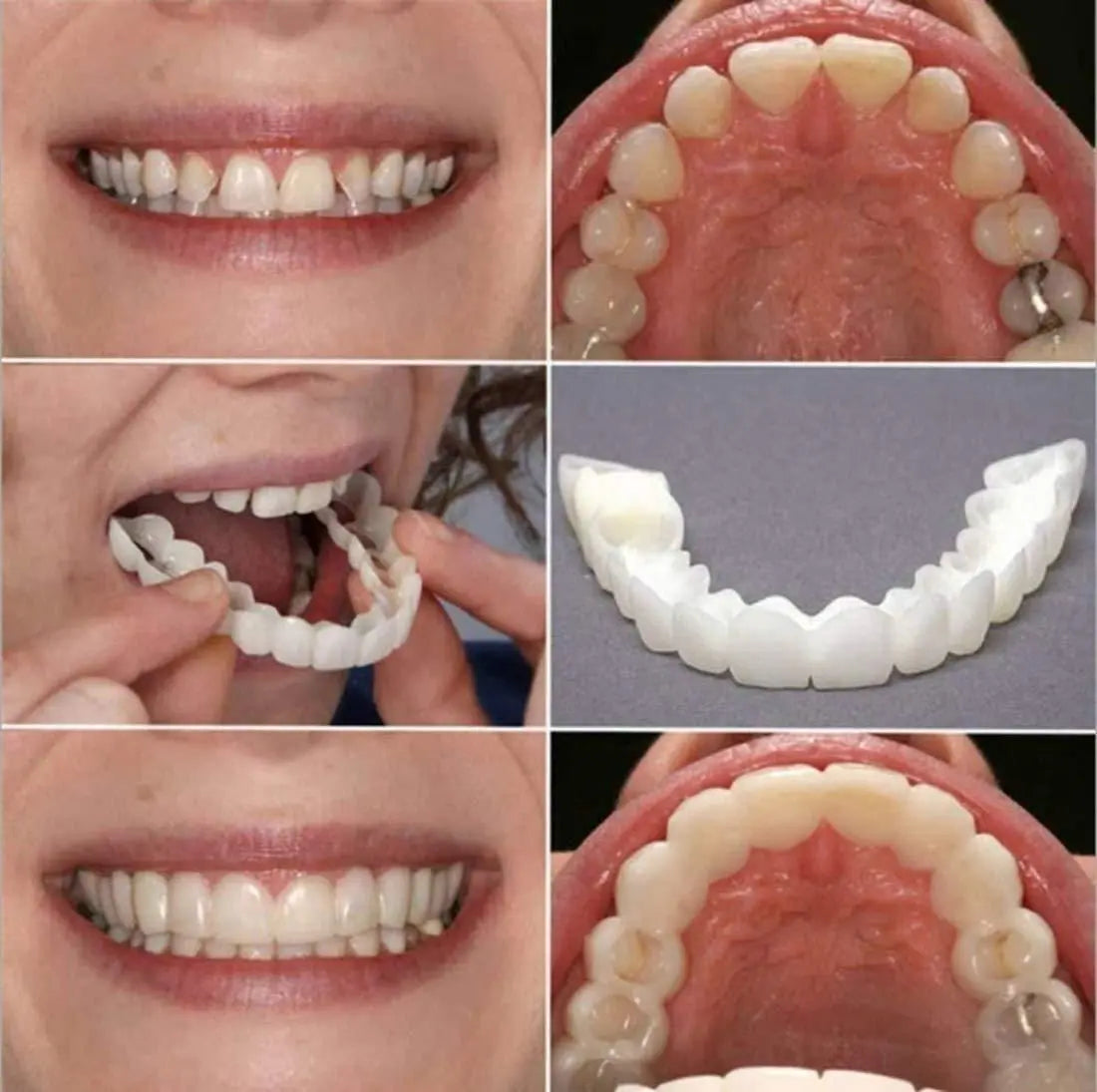 Advanced Cosmetic Teeth Denture (BUY 1 GET 1 FREE)